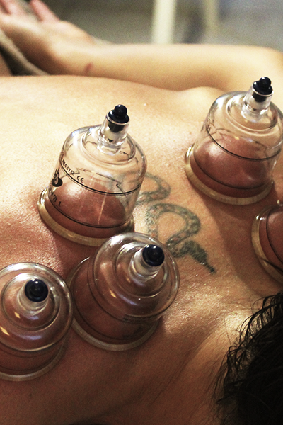 Trattamenti-studio-olistico-Naturaleza_Coppettazione-per-riattivare-il-flusso-sanguinio-facilitando-la-purificazione-del-sangue-3 Trattamenti-studio-olistico-Naturaleza_Coppettazione-per-riattivare-il-flusso-sanguinio-facilitando-la-purificazione-del-sangue