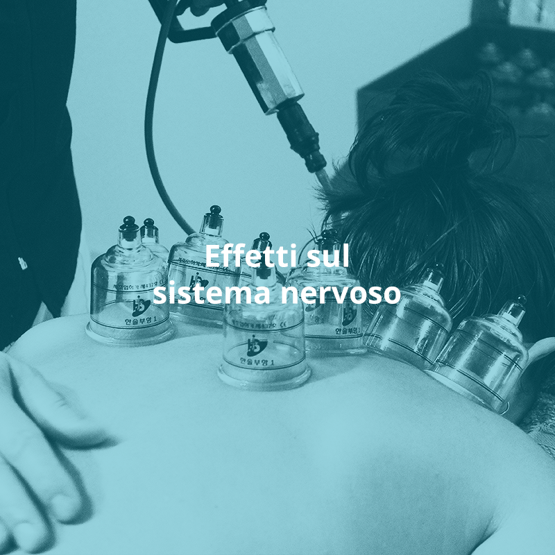 Trattamenti-studio-olistico-Naturaleza_Coppettazione-per-riattivare-il-flusso-sanguinio-facilitando-la-purificazione-del-sangue_6 Trattamenti-studio-olistico-Naturaleza_Coppettazione-per-riattivare-il-flusso-sanguinio-facilitando-la-purificazione-del-sangue. trattamento sistema circolatorio coppettazione